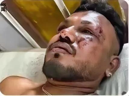 奇迹生还！男子接完父亲电话30秒后飞机坠毁爆炸