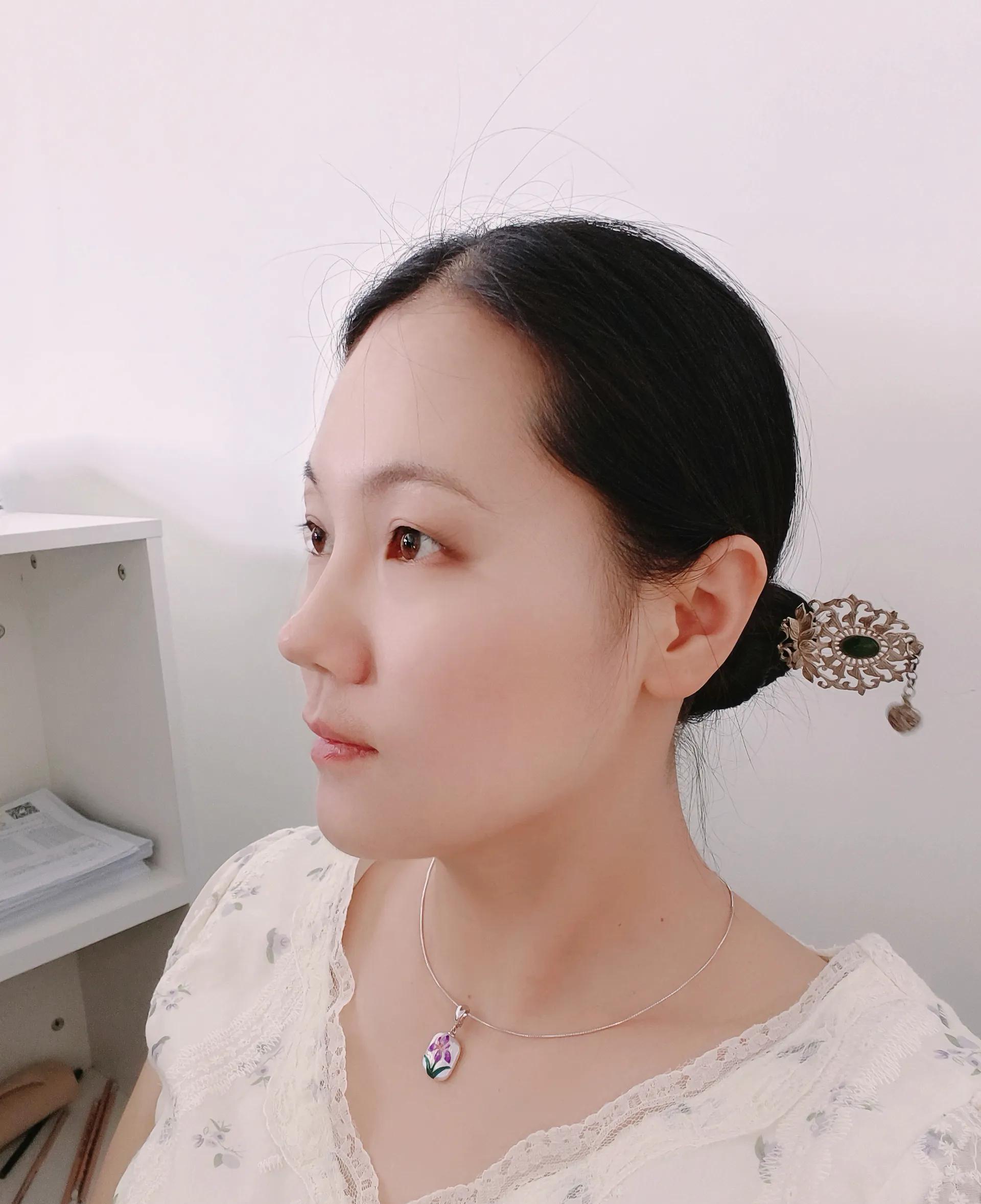 丑小鸭的逆袭